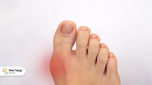 عوارض_اورده_حس_تازگی